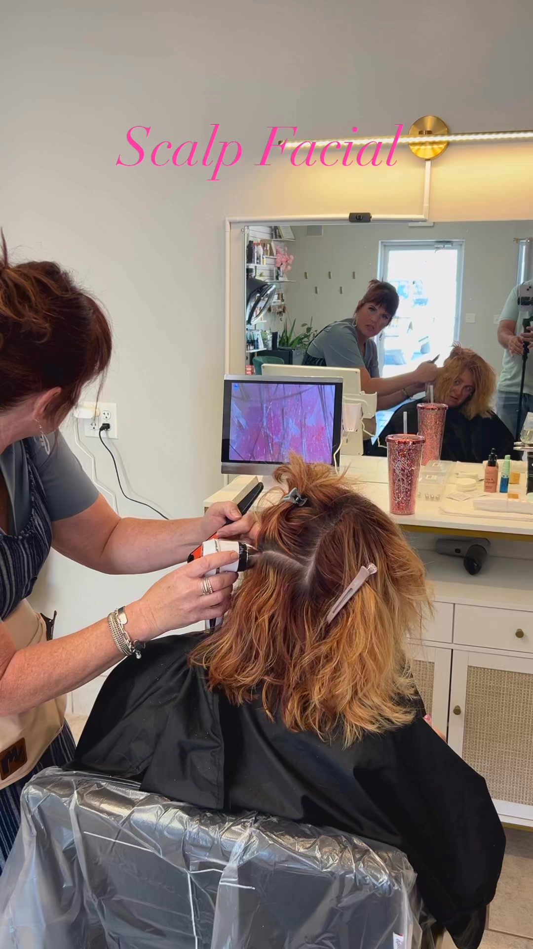 A magnified view of a client's scalp and hair follicles on the analysis monitor